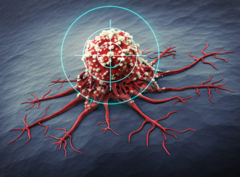 targeted therapy