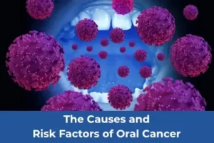 oral-cancer